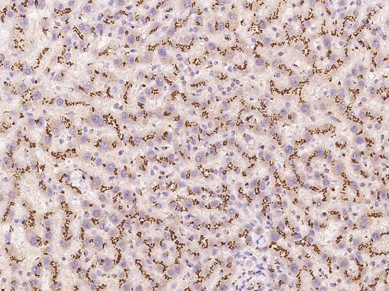 Polyclonal Rabbit anti-Human B4GALT1 Antibody (IHC, IF)