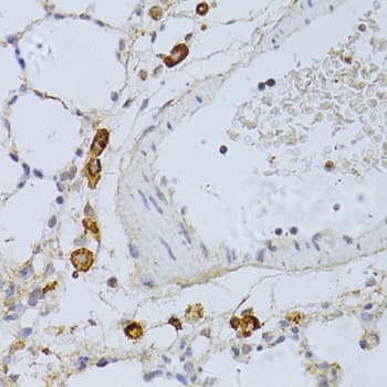 PHGDH Antibody
