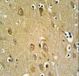 SYTL2 / SLP2 Antibody (aa840-868)
