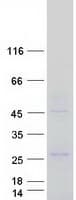 Human ZAR1 Protein (Recombinant Myc-DDK (Flag))