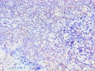 SMAD9 Antibody (aa1-300)