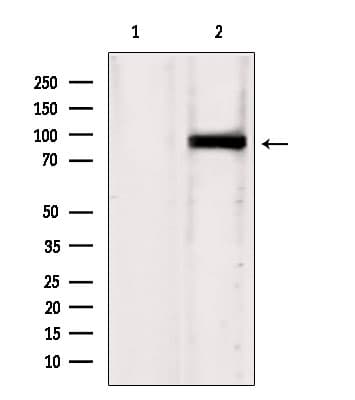 Polyclonal Rabbit anti-Human TG737 / IFT88 Antibody (IHC, WB)