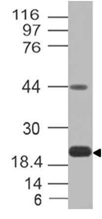 CD274 / B7-H1 / PD-L1 Antibody