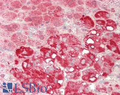 IHC-plus™ DDX19A Antibody (aa1-478)