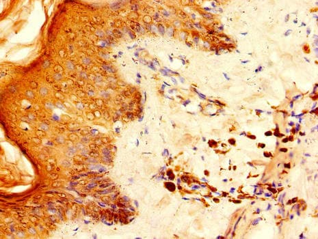 RPS6 / Ribosomal Protein S6 Antibody