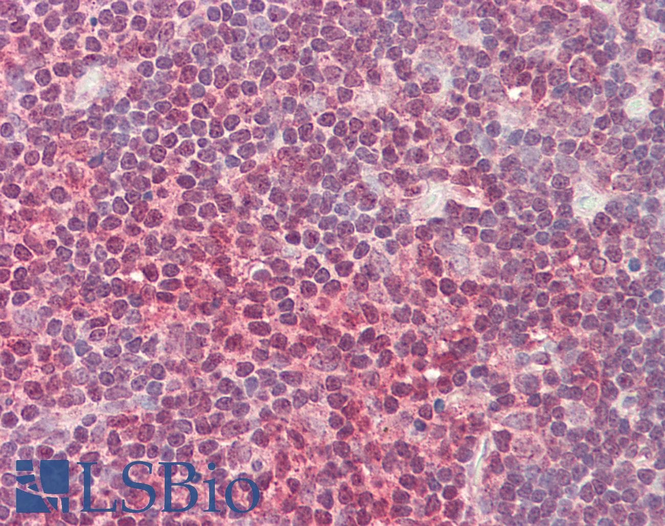 IHC-plus™ HEXIM1 Antibody (clone 2D12)