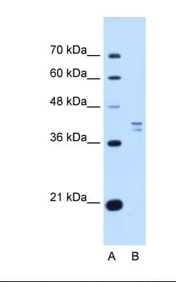 PSAT1 Antibody (aa99-148)