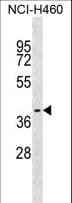 WBP2NL Antibody (aa9-36)