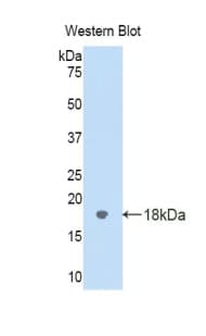 LGALS9 / Galectin 9 Antibody (aa17-147)