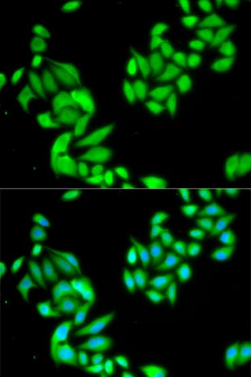 Polyclonal Rabbit anti-Human IKBKB / IKK2 / IKK Beta Antibody (IHC, IF, WB)