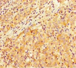Polyclonal Rabbit anti-Human SMARCA4 / BRG1 Antibody (IHC, IF)