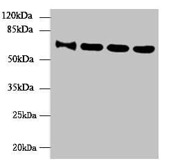 Polyclonal Rabbit anti-Human NUPL1 Antibody (aa211-480, IHC, WB)