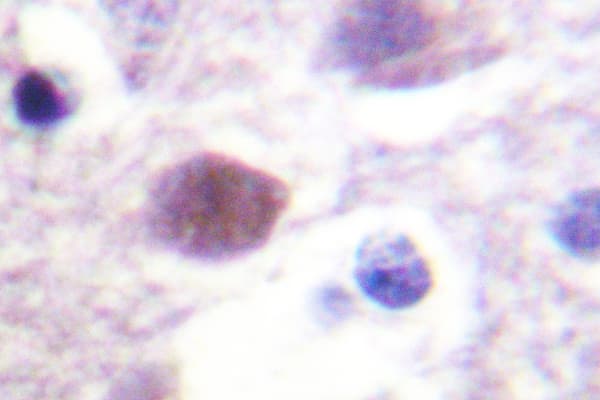 PRKDC / DNA-PKcs Antibody (Tyr2052)