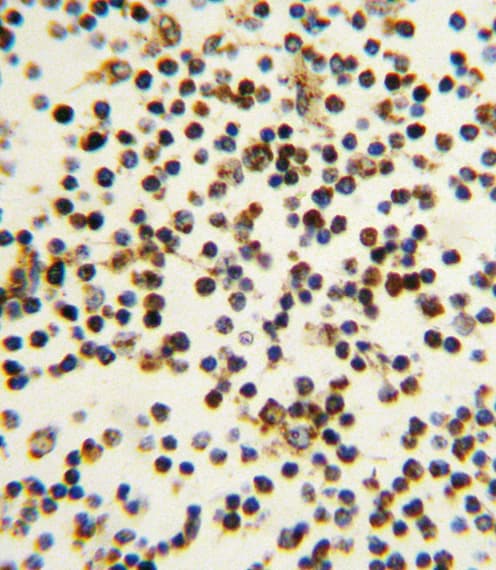 NPM1 / NPM / Nucleophosmin Antibody (aa7-33)