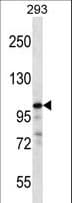 RASA1 Antibody (aa966-993)