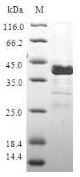 Human CALCB Protein (Recombinant GST, N-terminus)