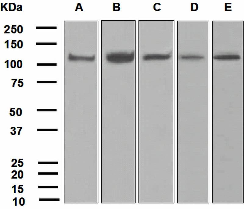 IHC-plus™ USP11 Antibody (Internal, clone EPR4346)