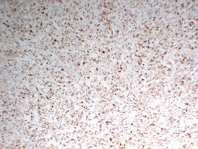 CD68 Antibody (clone ABT-CD68)