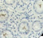 Helicobacter pylori Antibody (Ready-to-Use)
