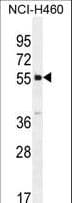 SHISA6 Antibody (aa81-109)