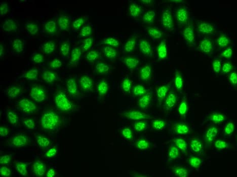 Polyclonal Rabbit anti-Human RAD17 Antibody (IHC, IF, WB)