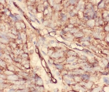 Polyclonal Rabbit anti-Human CD34 Antibody (aa151-385, IHC, WB)