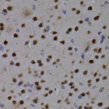 Polyclonal Rabbit anti-Human MEF2C Antibody (IHC, WB)