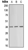 PRKAG1 / AMPK Gamma 1 Antibody (N-Terminus)