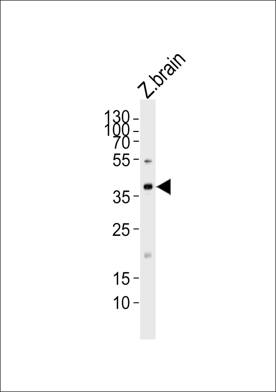 MAB21L2 Antibody (aa185-219)