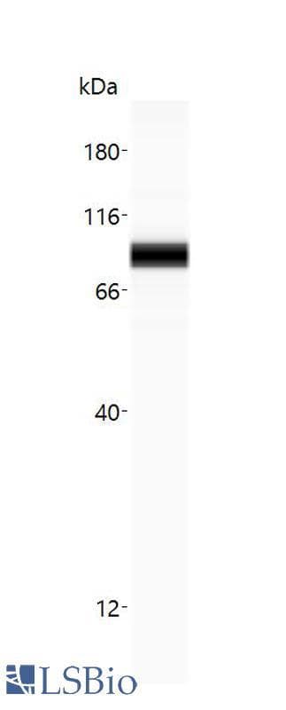 PathPlus™ CTNNB1 / Beta Catenin Antibody