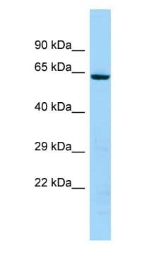 Polyclonal Rabbit anti-Human KRT74 / Keratin 74 Antibody (C-Terminus, WB)