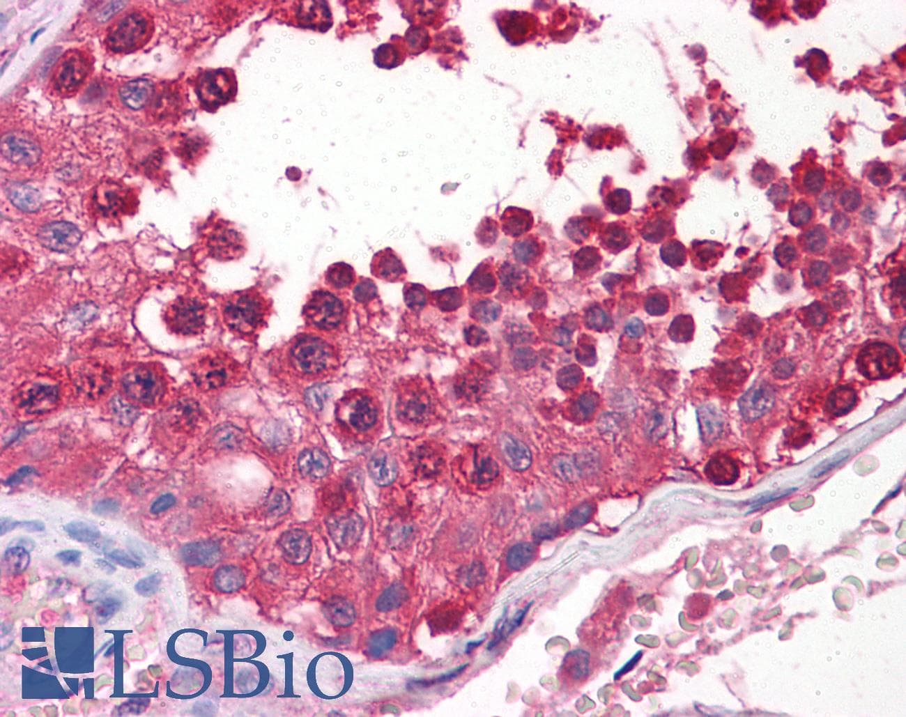 IHC-plus™ Monoclonal Mouse anti-Human CSE1L Antibody (clone 2F4, IHC, IF, WB)