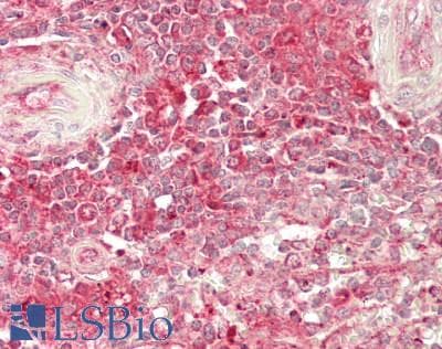 HCK Antibody (aa295-344)
