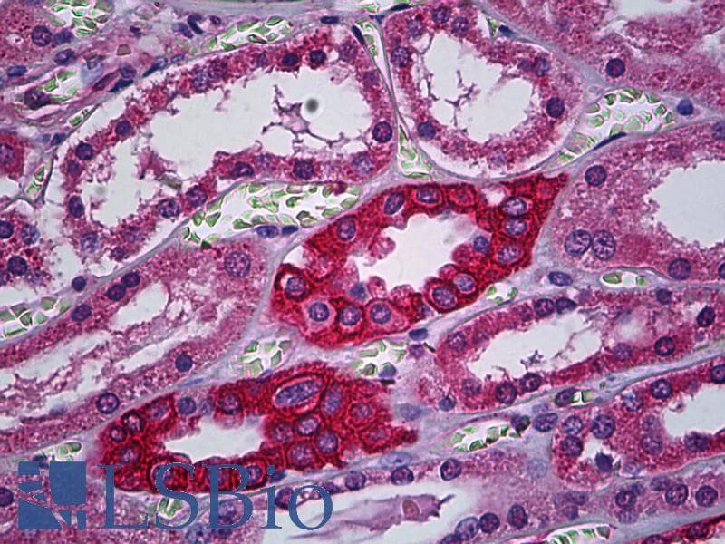 IHC-plus™ CACNA2D2 Antibody (clone 3A4)