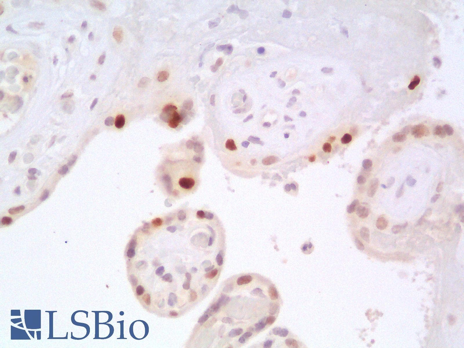 PathPlus™ TP53 / p53 Antibody (Concentrated)