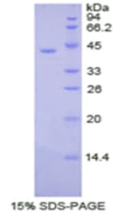 Human CKB / Creatine Kinase BB Protein (Recombinant His)