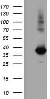 MGLL / Monoacylglycerol Lipase Antibody (clone OTI1H2, Carrier-free)