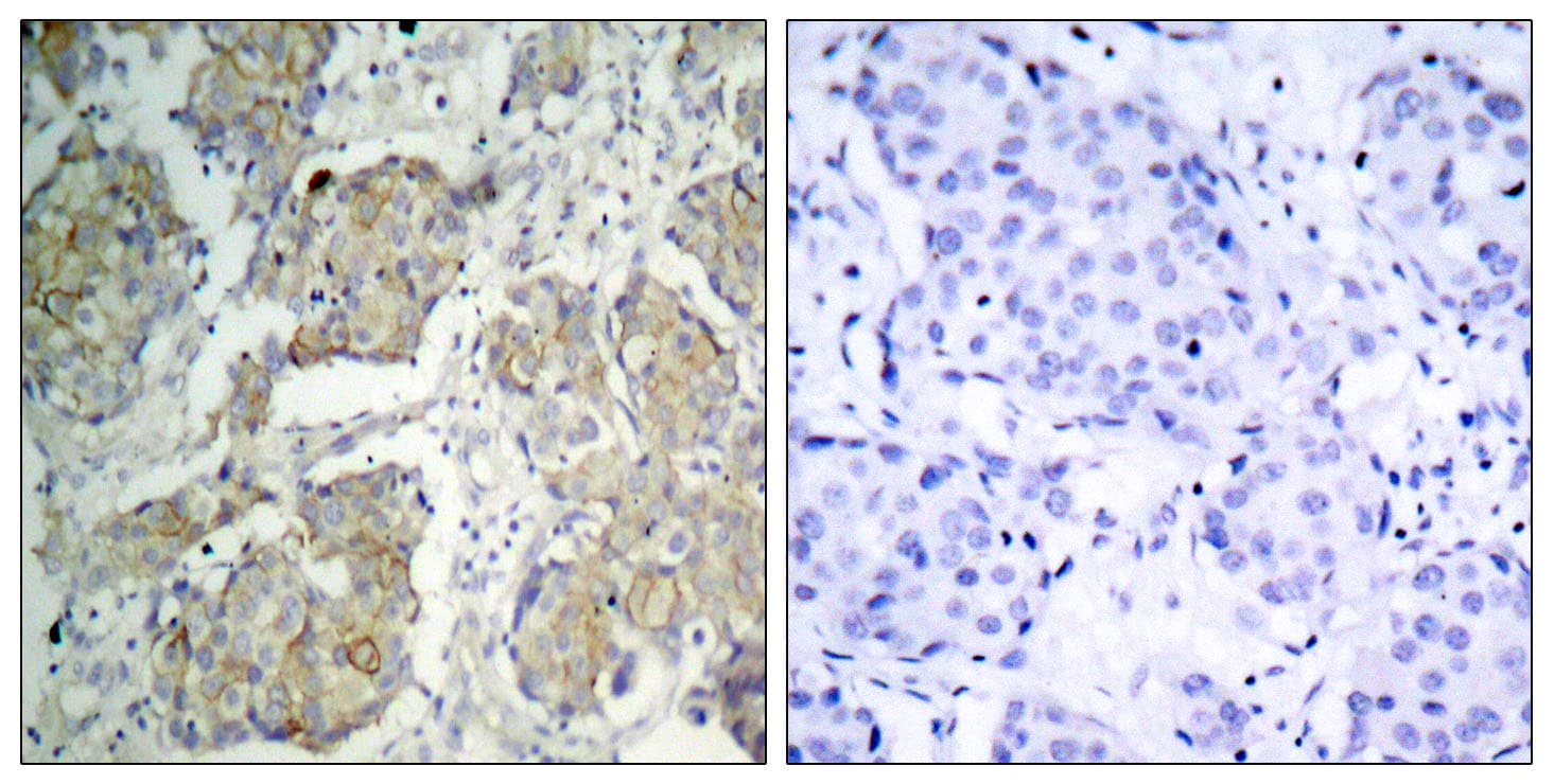 KDR / VEGFR2 / FLK1 Antibody (phospho-Tyr1214)