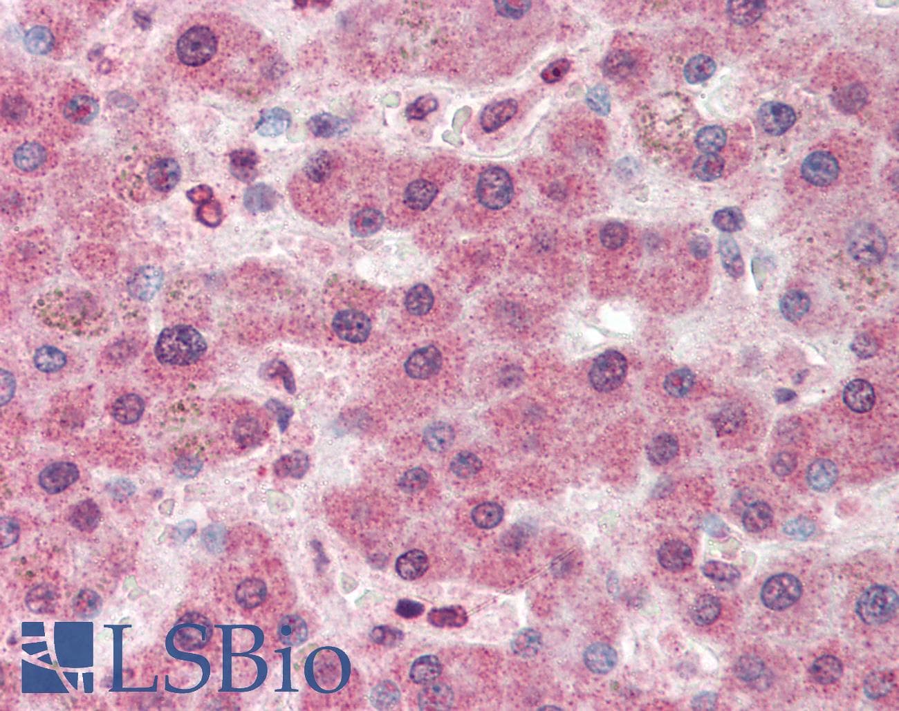 IHC-plus™ Polyclonal Goat anti-Human PC / Pyruvate Carboxylase Antibody (aa886-899, IHC, WB)