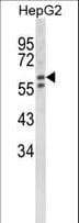 HEXA Antibody (aa315-343)