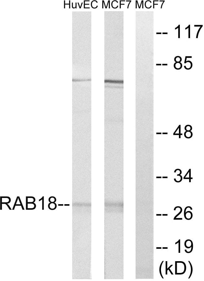 RAB18 Antibody