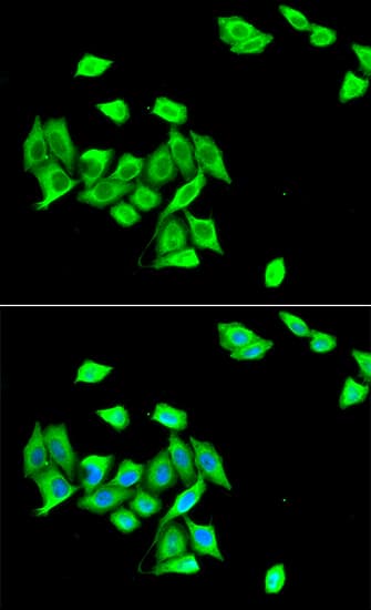 DNMT3A Antibody