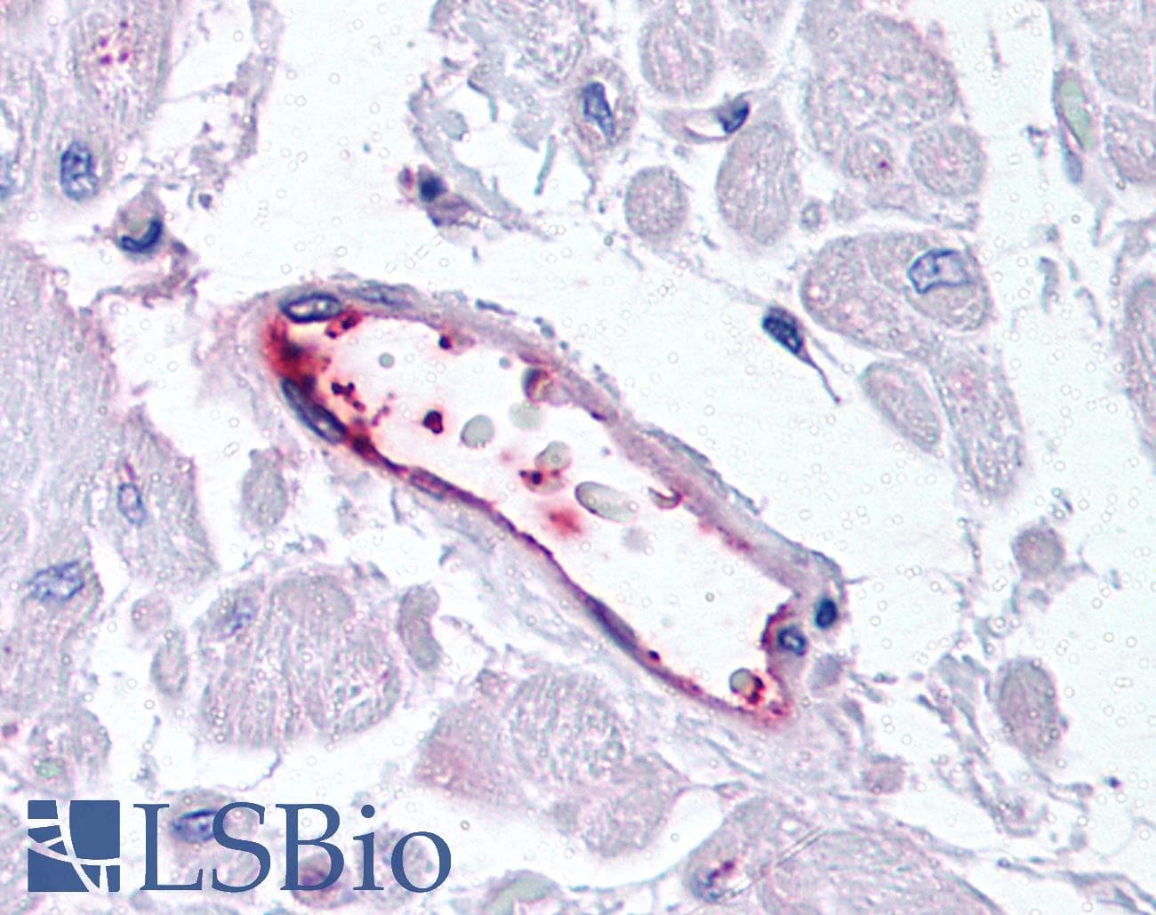IHC-plus™ HUNK / B19 Antibody (C-Terminus)