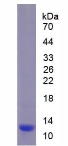 Mouse DEFB1 / BD-1 Protein (Recombinant His-S)