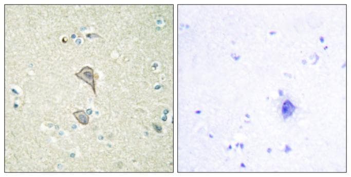 Polyclonal Rabbit anti-Human NKTR Antibody (IHC, IF)