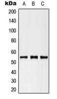 Polyclonal Rabbit anti-Human KRT8 / CK8 / Cytokeratin 8 Antibody (phospho-Ser73, WB)
