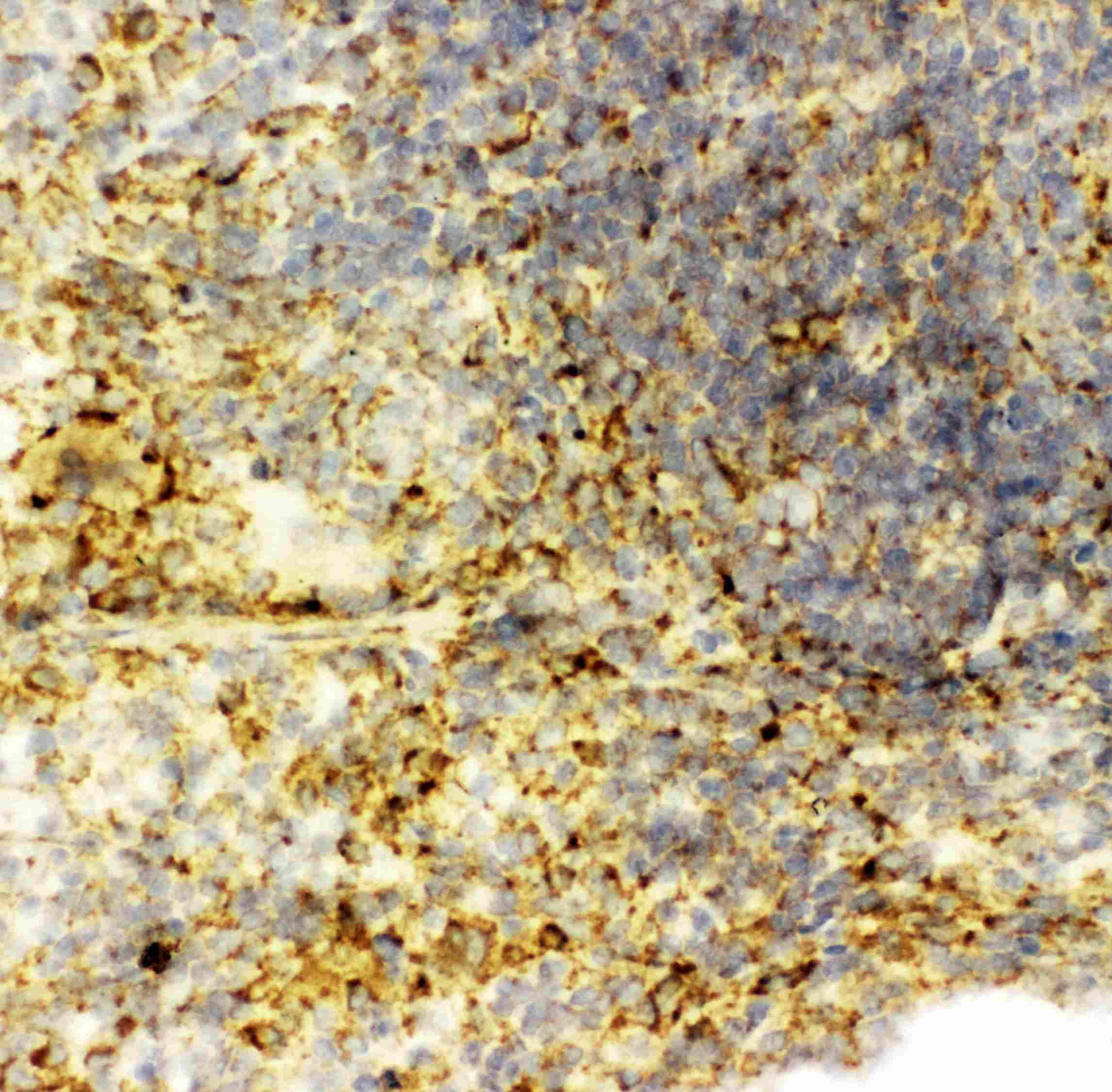 CASP6 / Caspase 6 Antibody (aa7-27)