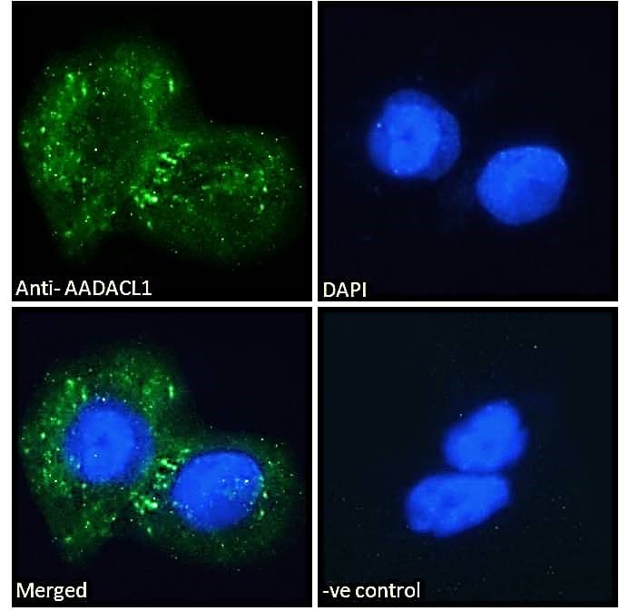 Polyclonal Goat anti-Human NCEH1 / AADACL1 Antibody (aa403-415, IF)