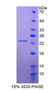 Human FGF10 Protein (Recombinant His-T7)