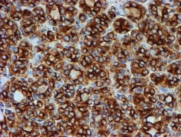 TUBB4 / Tubulin Beta 4 Antibody (clone OTI3F1, Carrier-free)